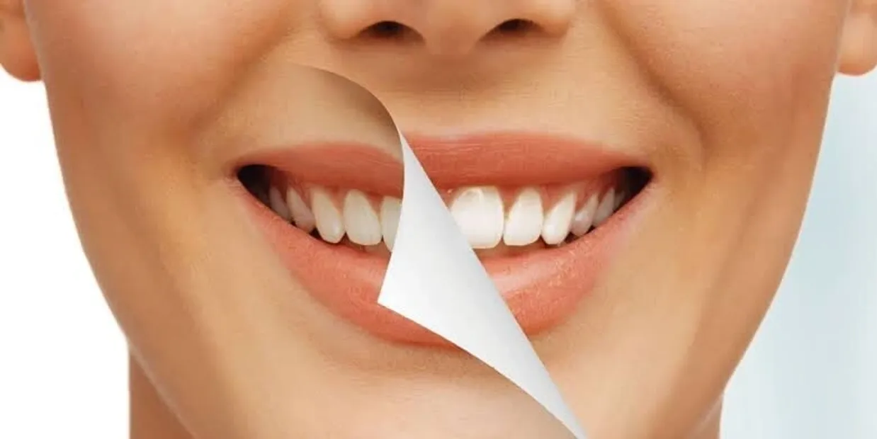 Can Laser Teeth Whitening Damage Your Dental Crowns Worthing?