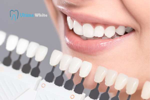 How to Maximise the Results of Your Laser Teeth Whitening Treatment Worthing