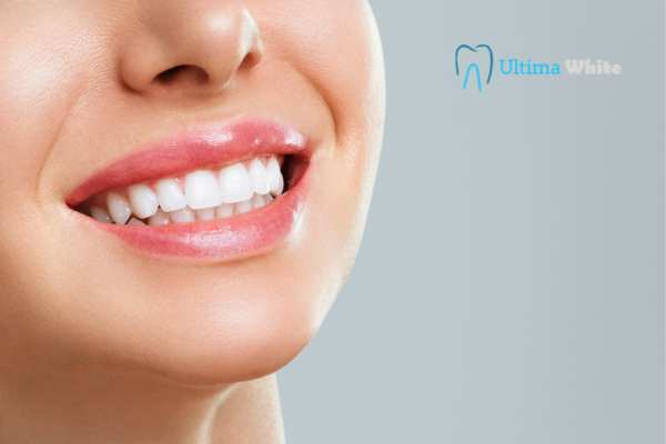 Common Mistakes That Can Ruin Your Whitening Results Worthing