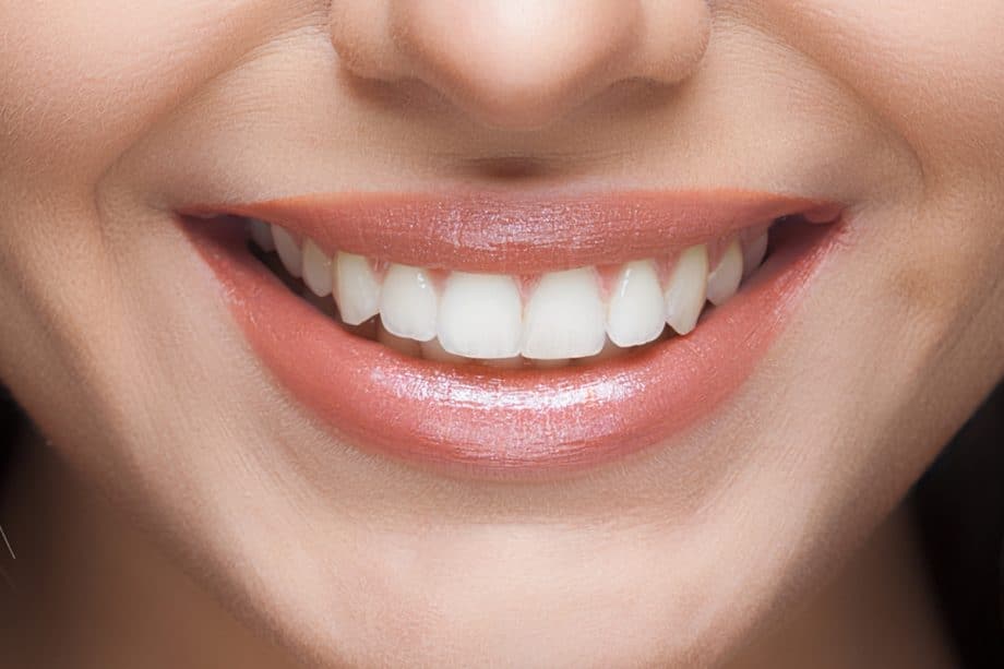 The Role of a Balanced Diet in Long-Term Whitening Results Worthing