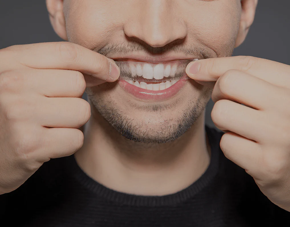 What to Consider Before Choosing a Teeth Whitening Option Worthing