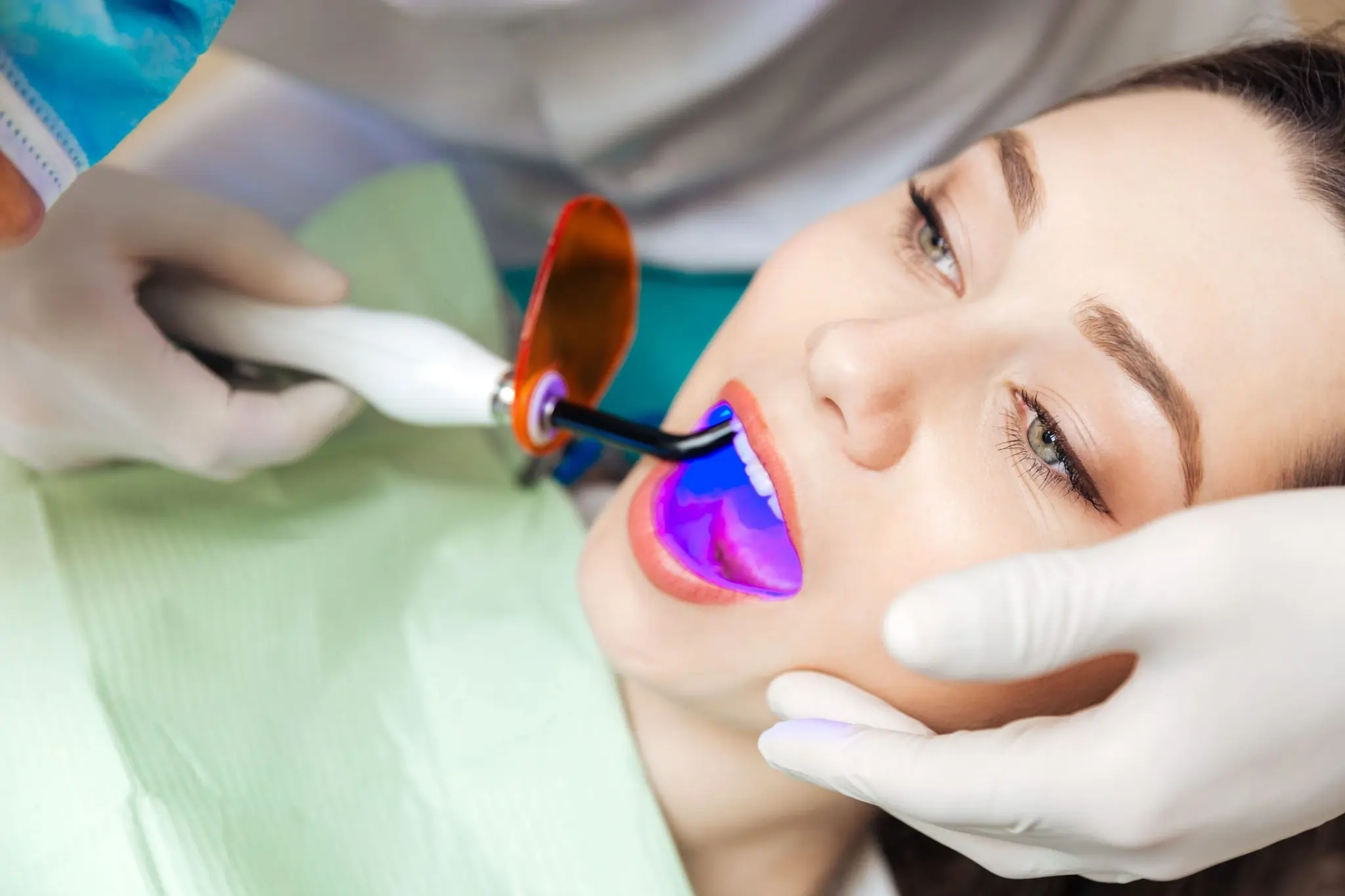 How Can You Protect Your Smile After Laser Whitening Worthing?