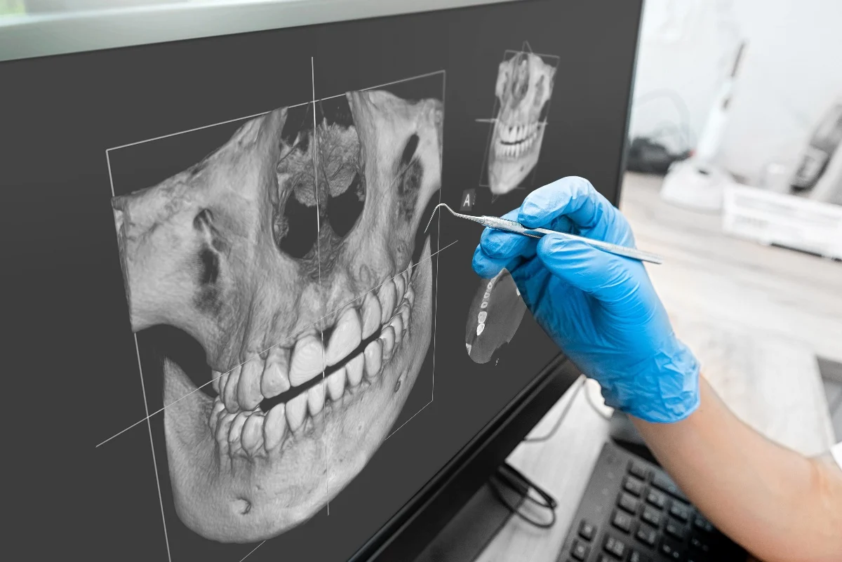 How Is AI Transforming Dental Treatment Planning Worthing?