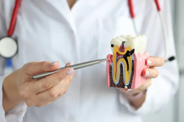 Which Whitening Methods Are Gentler on Sensitive Teeth Worthing?