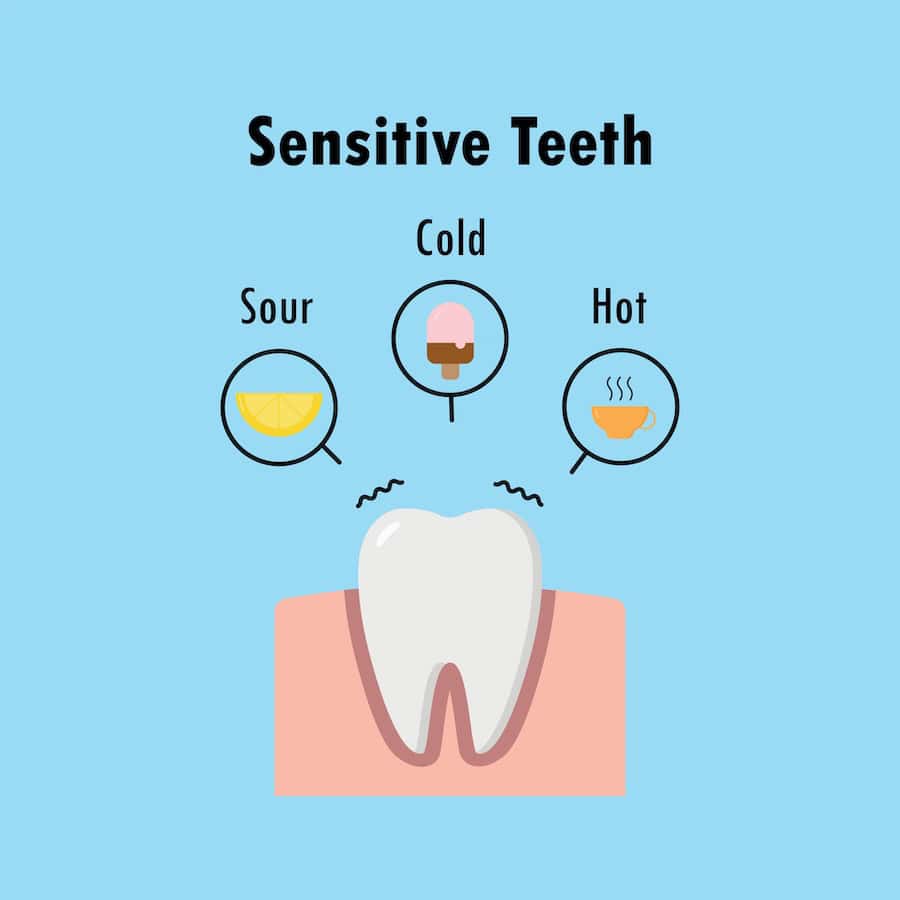 Why Do Teeth Become Sensitive After Whitening Treatments Worthing?