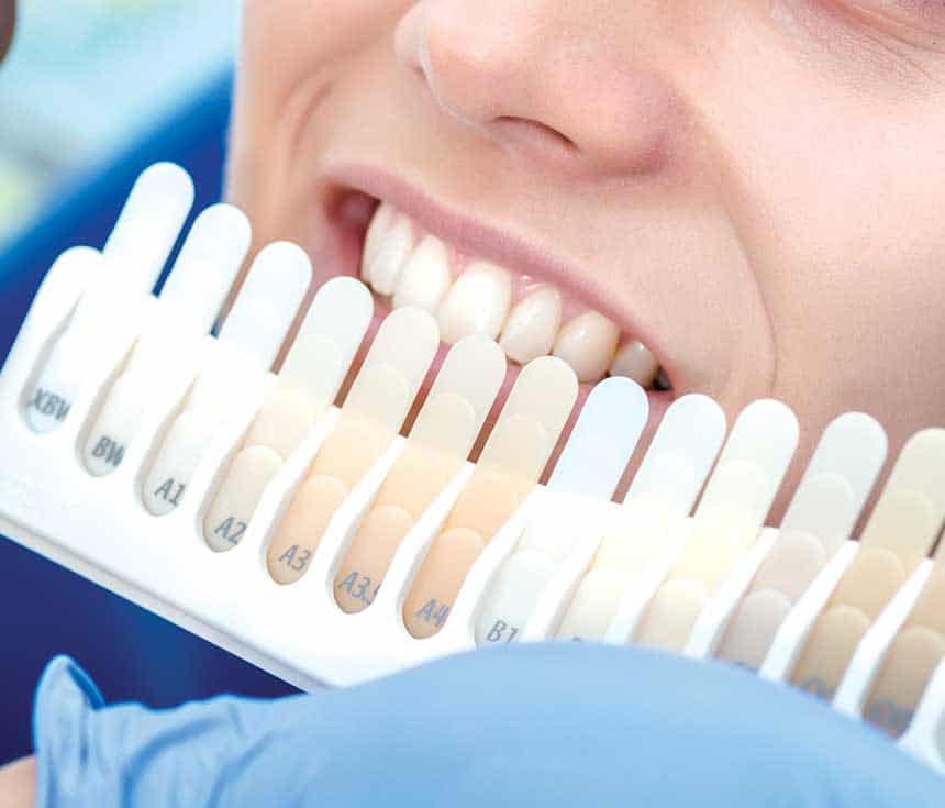 Is Laser Teeth Whitening Worth It for a Brighter, Confident Smile Worthing?