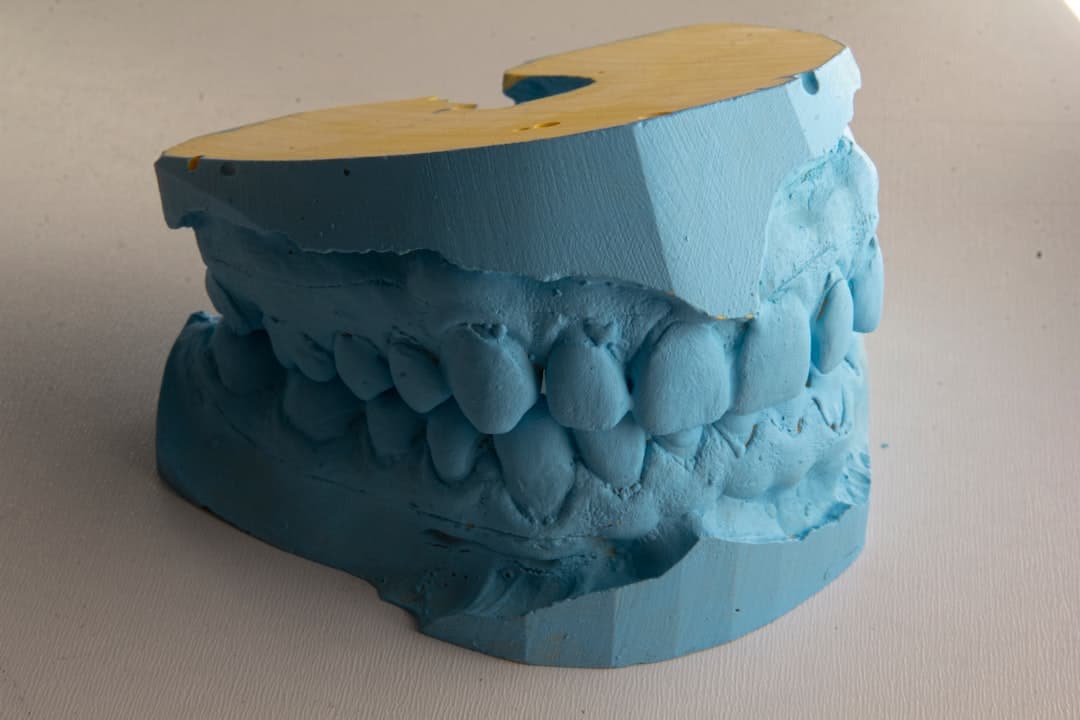 How Do Dental Implants Improve Jawbone Health and Oral Function Worthing?