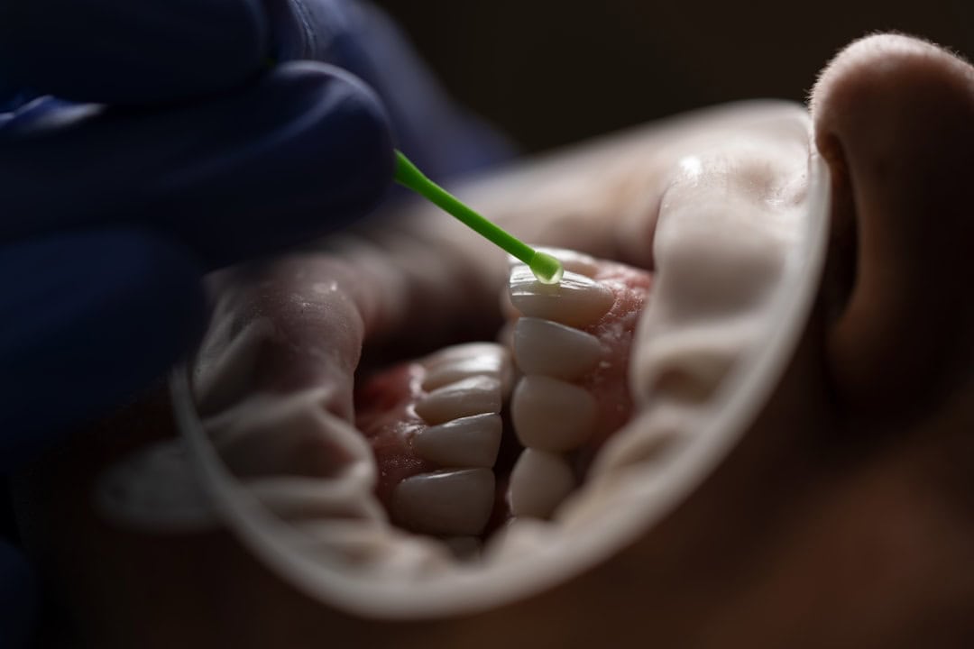The Role of Saliva: Nature’s Defense System Worthing
