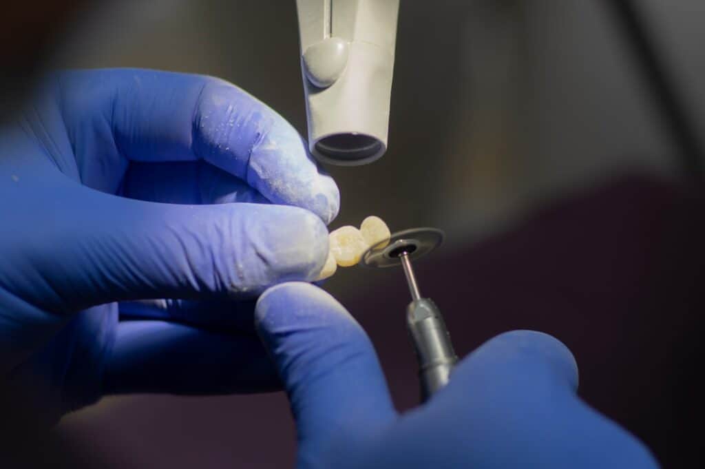 Customised Dental Solutions: Crowns, Aligners, and Implants Worthing